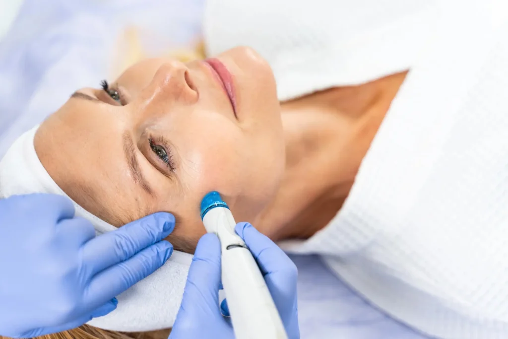 microdermabrasion
